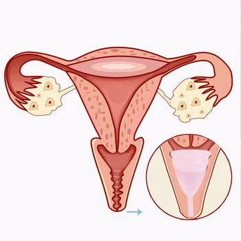 Medicininio Silikono Menstruacinis Puodelis Sterilizer Moteriškos higienos Menstruacijų Taurės Sterilizuoti Menstruacijų Taurės Moterų Menstruacijų