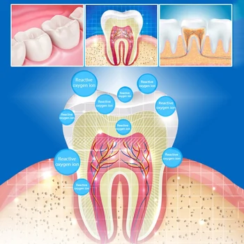 7PCS Dantų Balinimo Juostelių Rinkinį Valymas Dantų Pleistrų Rinkinys Pašalinti Geltonos Dantų Dėmių Blogas kvapas Burnos Higienos Priežiūros